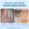 Anti-Rimpel Halscrème