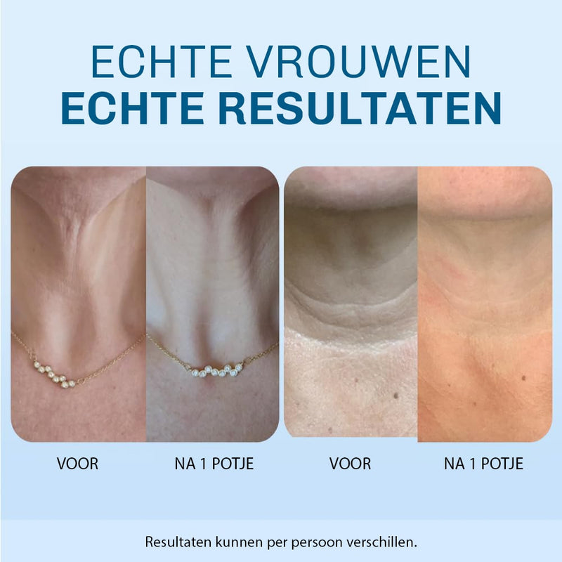 Anti-Rimpel Halscrème