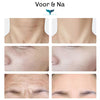 LumiFace Anti-Age Apparaat