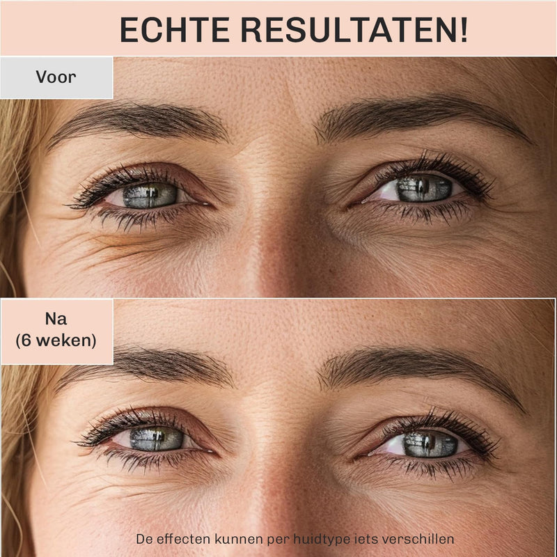 Oogcrème AgeRepair 7