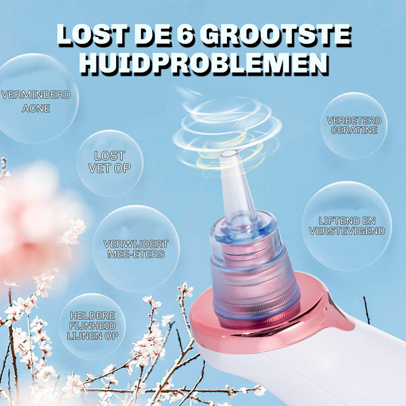 Mee-eter Verwijderaar SkinClear 3