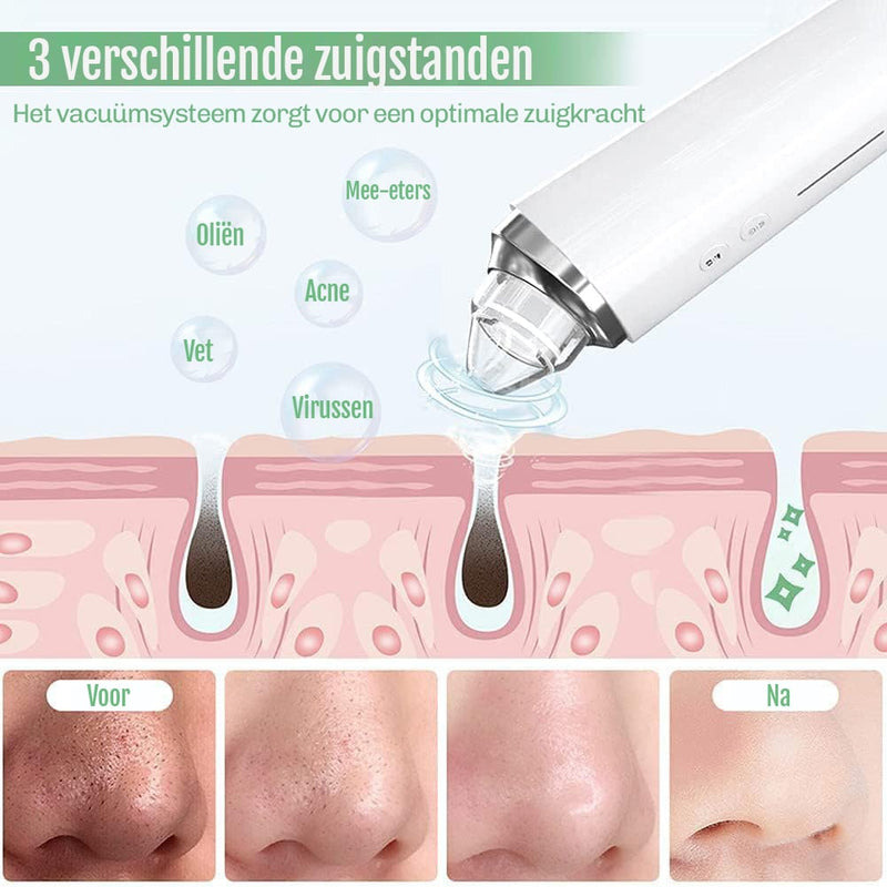 Mee-eter verwijderaar met camera