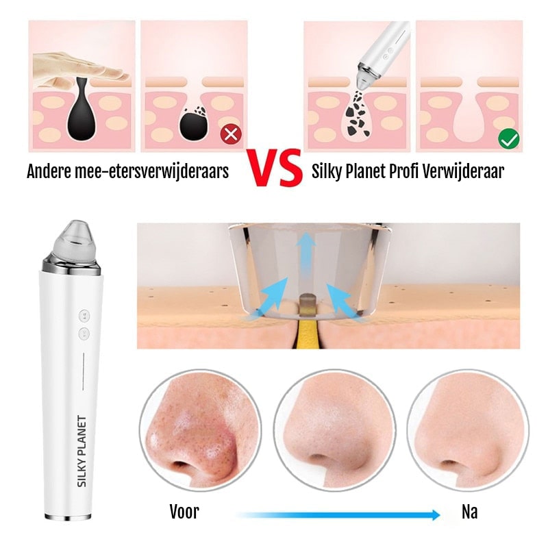 Mee-eter verwijderaar met camera