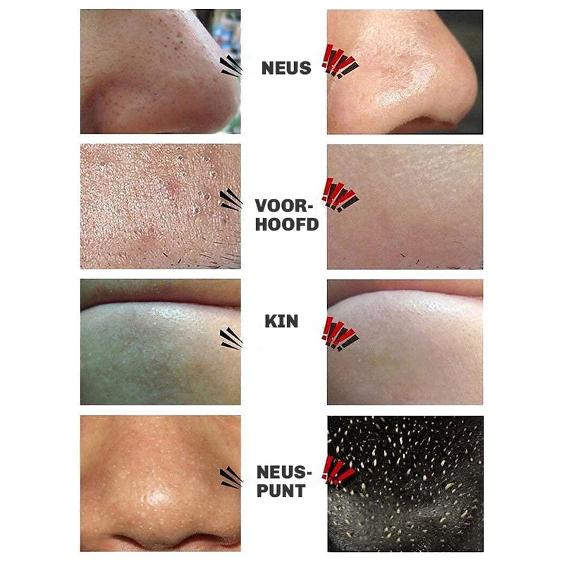 Mee-eter Verwijder Black Masker