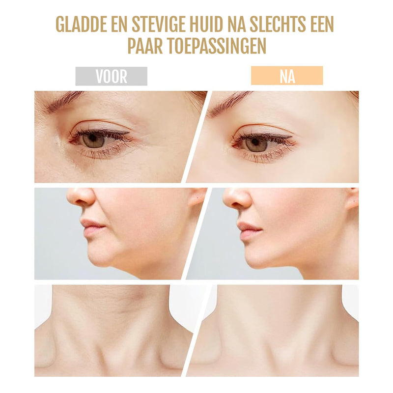 Faceliftapparaat Micro Glow