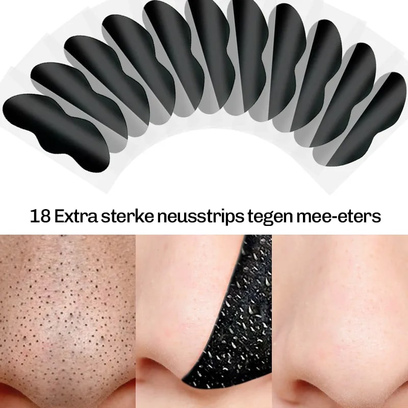 Mee-eter neusstrips