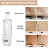 DermaGlow 5 Ultrasoon Peelingapparaat