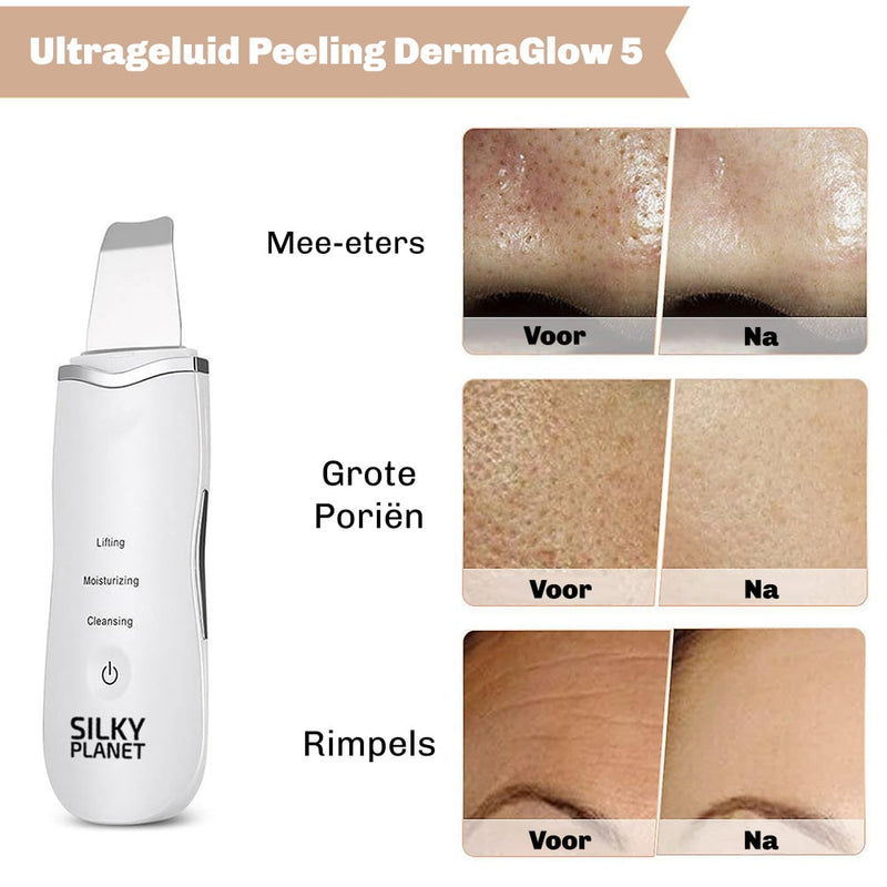 DermaGlow 5 Ultrasoon Peelingapparaat