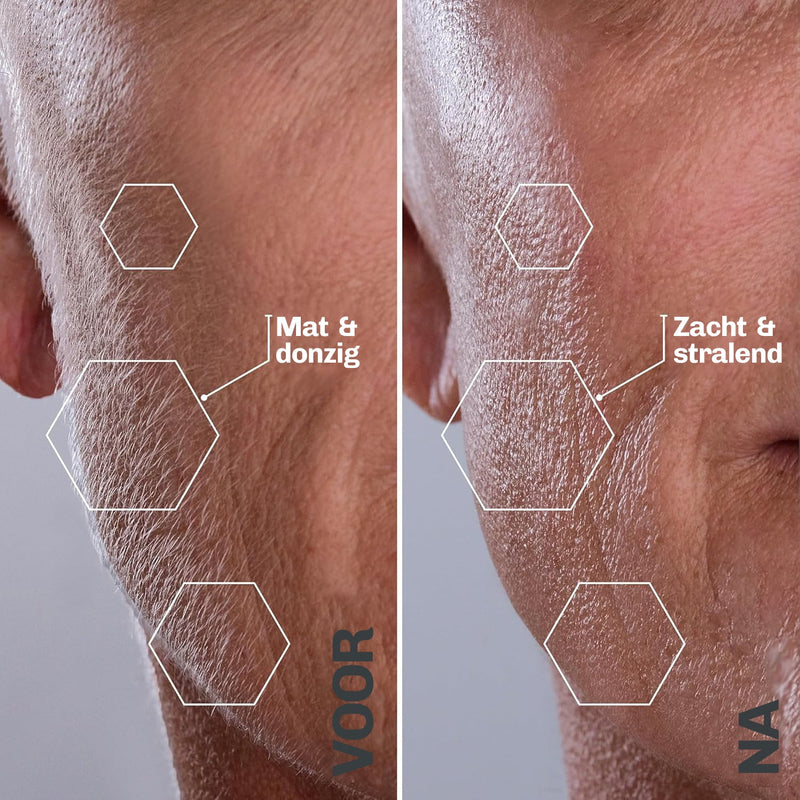 Ultrasone Haarverwijdering SILKYFLASH+