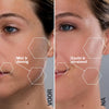 Ultrasone Haarverwijdering SILKYFLASH+