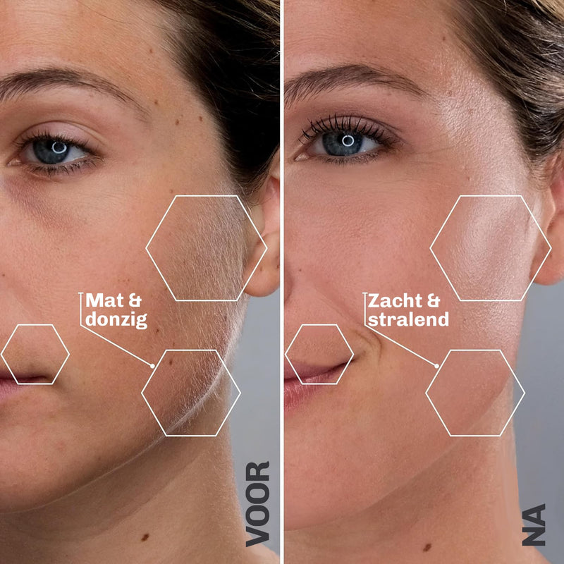 Ultrasone Haarverwijdering SILKYFLASH+