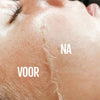 Ultrasone Haarverwijdering SILKYFLASH+