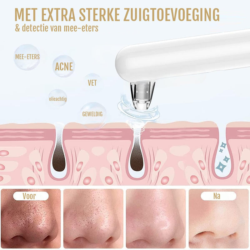 Mee-eterverwijderaar PoreXpert