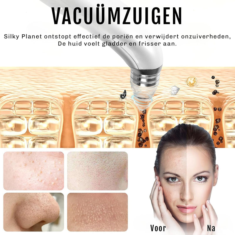 Mee-eterverwijderaar PoreXpert