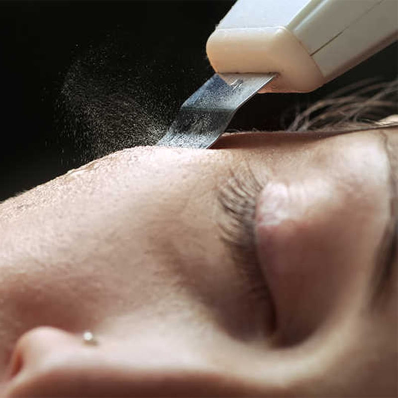 DermaGlow 5 Ultrasoon Peelingapparaat