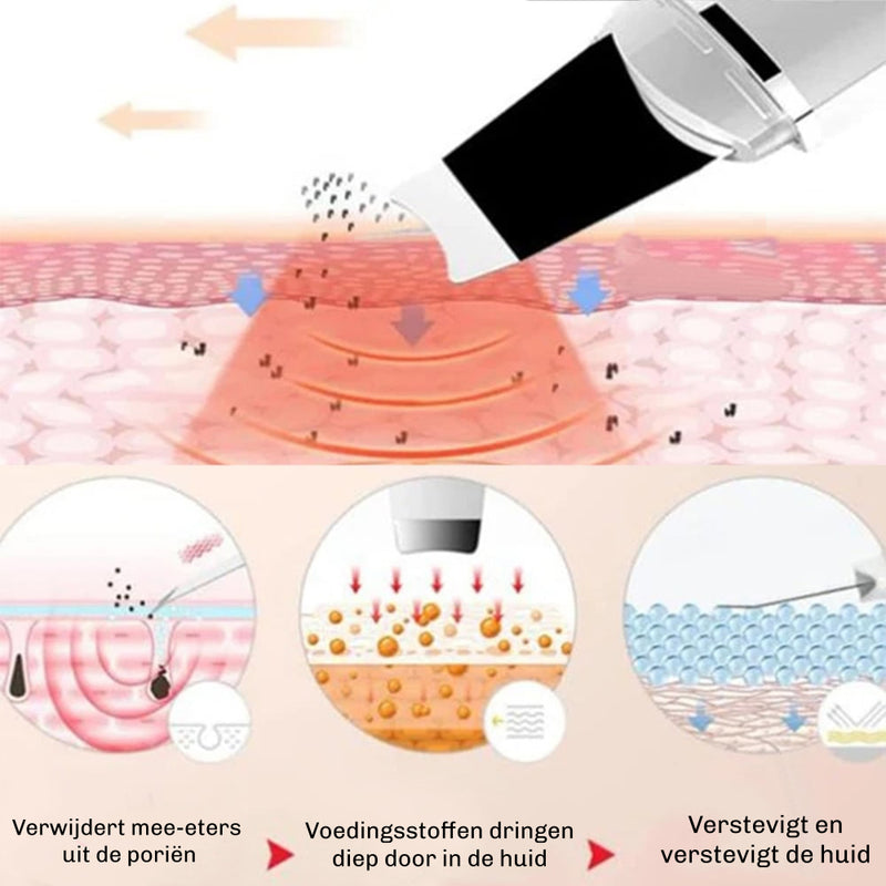 DermaGlow 5 Ultrasoon Peelingapparaat