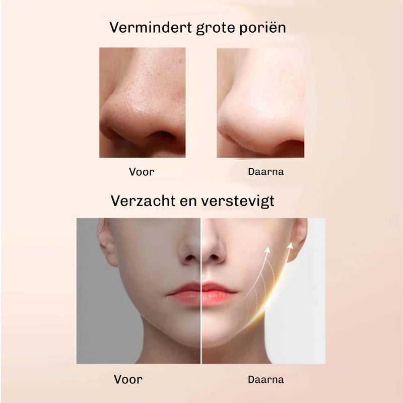 DermaGlow 5 Ultrasoon Peelingapparaat